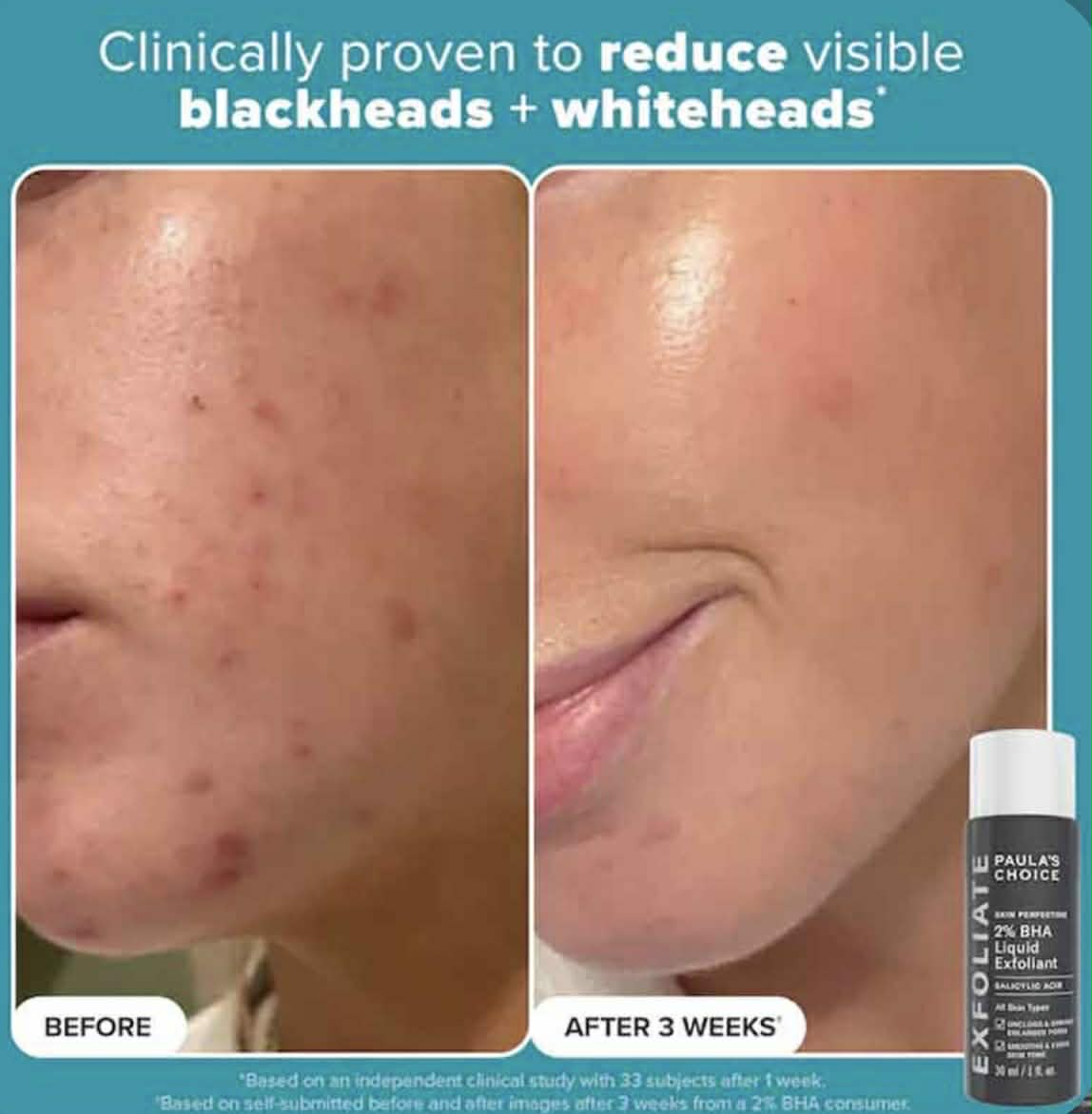 Multi-Level Exfoliation Trial Kit - Duo Découverte Exfoliants AHA + BHA