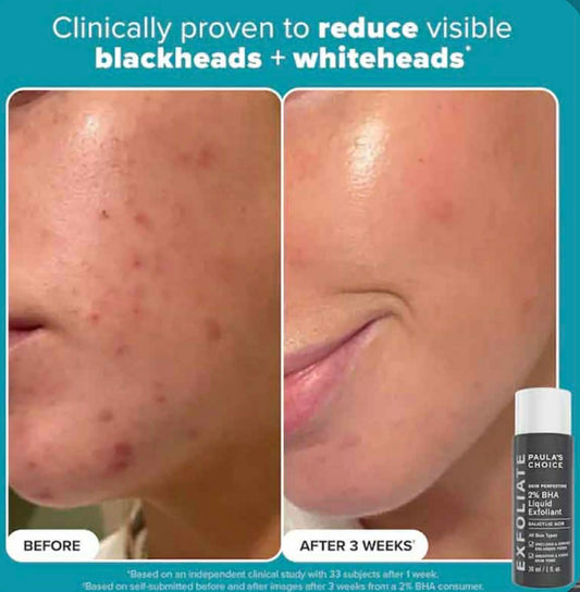 Multi-Level Exfoliation Trial Kit - Duo Découverte Exfoliants AHA + BHA